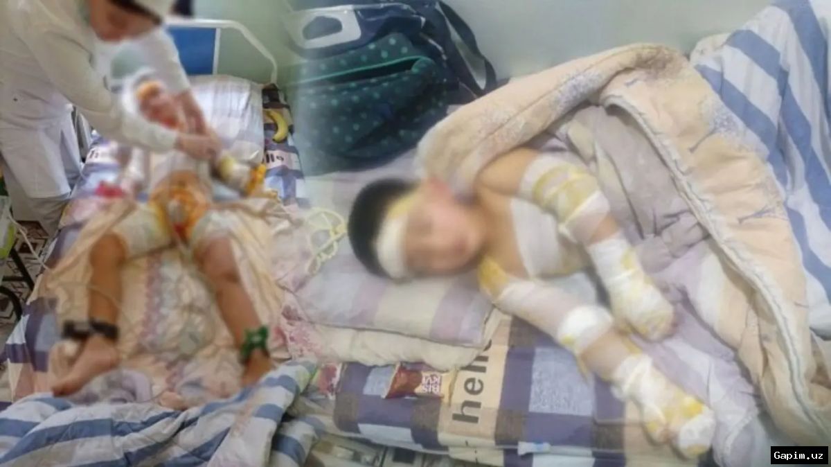 ⚡️👶 В Намангане 4-летний мальчик лишился рук из-за открытой трансформаторной подстанции