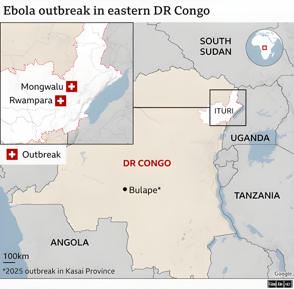 🦠⚠️ Kongo Demokratik Respublikasida Ebola epidemiyasi: 100 dan ortiq o‘lim, 390 dan ziyod gumon qilinayotgan holatlar