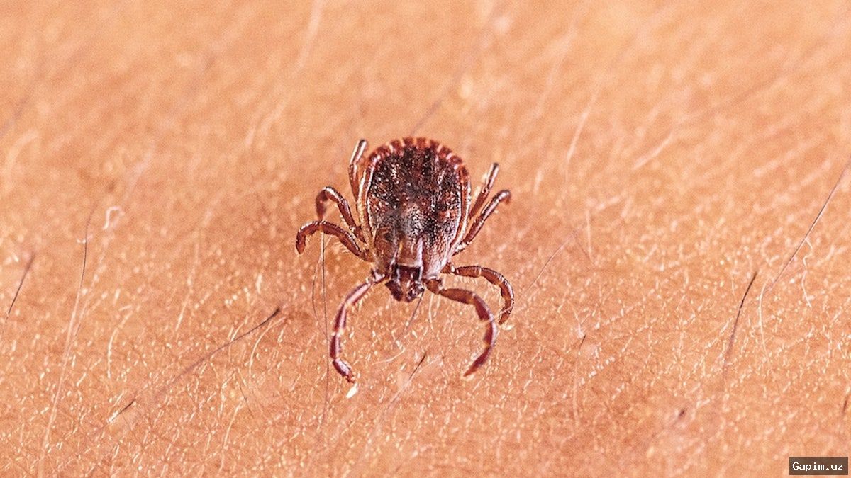 🦠🕷️ Xitoyda yangi virus aniqlandi: kene chaqishi orqali yuqadi