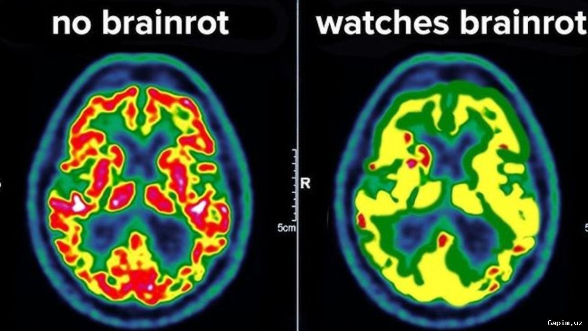 🧠📱 Короткие видео перегружают мозг: Ученые бьют тревогу
