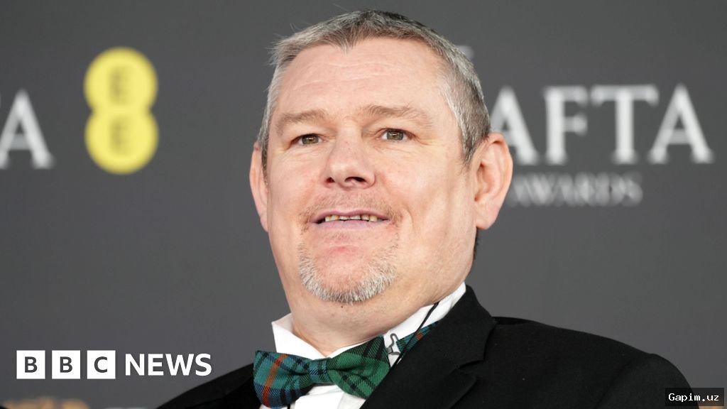 Saturday Night Live 'Turet sindromi' haqidagi skechi uchun tanqid qilindi