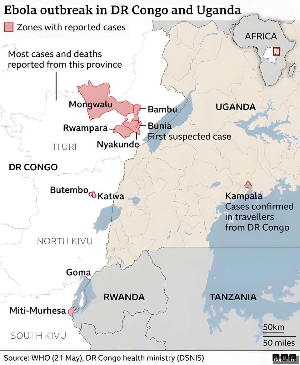 🦠⚠️ JSST: Ebola epidemiyasi rasmiy maʼlumotlardan 2-4 baravar katta