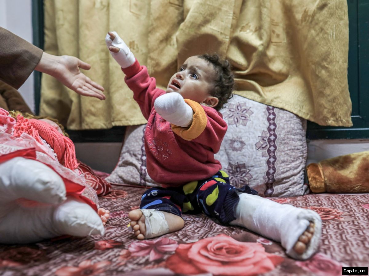 ⚕️🦿 Число ампутаций в Газе достигло рекордного уровня: Израиль продолжает ограничивать помощь