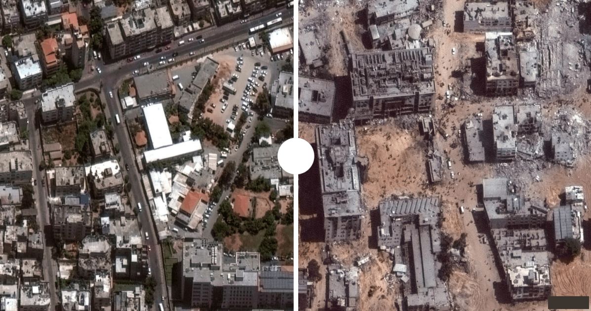 🏥💔 Gaza's medical imaging crisis: patients face life-threatening delays