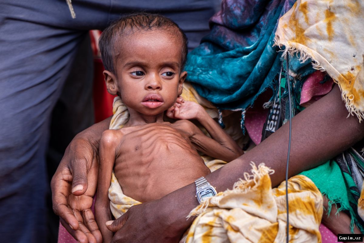 🌍⚠️ Somalia hunger crisis: millions go hungry as drought, funding cuts deepen catastrophe