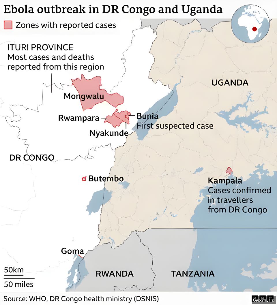 🦠⚔️ WHO chief calls for immediate ceasefire in DR Congo to tackle Ebola outbreak