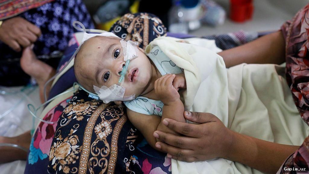 ⚰️📉 Bangladeshda qizamiq epidemiyasi: 500 dan ortiq bola vafot etdi